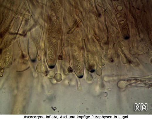 Ascocoryne inflata, kopfige Paraphysen