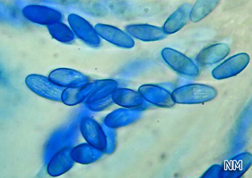 Nectria peziza - Eingedrückter Pustelpilz, Sporen