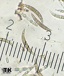 Sporen Melogramma campylosporium